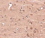 GLE1 Polyclonal Antibody