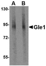 GLE1 Antibody in Western Blot (WB)