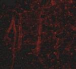 GLE1 Antibody in Immunohistochemistry (IHC)