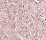 GLE1 Polyclonal Antibody