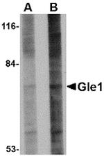 GLE1 Antibody in Western Blot (WB)