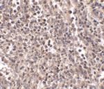 EBI3 Polyclonal Antibody