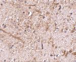 TOM70 Polyclonal Antibody