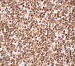 TREX1 Polyclonal Antibody