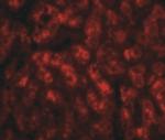 TREX2 Polyclonal Antibody
