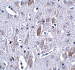 IL-16 Polyclonal Antibody