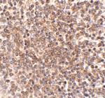 OCC1 Polyclonal Antibody