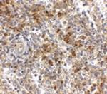 OCC1 Polyclonal Antibody