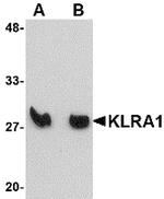 KLRA1 Antibody in Western Blot (WB)