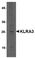 KLRA3 Polyclonal Antibody