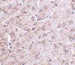 CRMP1 Polyclonal Antibody