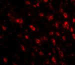 TTBK1 Antibody in Immunohistochemistry (IHC)