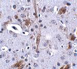 TTBK1 Polyclonal Antibody