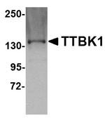 TTBK1 Antibody in Western Blot (WB)