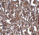 KLRA2 Polyclonal Antibody