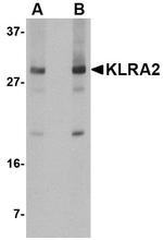 KLRA2 Antibody in Western Blot (WB)