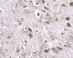 TMEM18 Antibody in Immunohistochemistry (IHC)