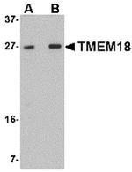 TMEM18 Antibody in Western Blot (WB)