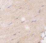 FNIP2 Polyclonal Antibody