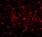CDIP1 Antibody in Immunohistochemistry (IHC)