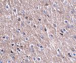 CDIP1 Polyclonal Antibody
