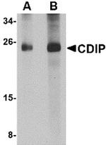 CDIP1 Antibody in Western Blot (WB)
