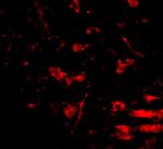 RCAN2 Antibody in Immunohistochemistry (IHC)