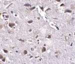 RCAN2 Polyclonal Antibody