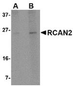 RCAN2 Antibody in Western Blot (WB)