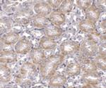 MTCH2 Antibody in Immunohistochemistry (IHC)