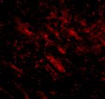 CDIP1 Antibody in Immunohistochemistry (IHC)