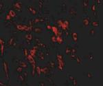 LRFN1 Antibody in Immunohistochemistry (IHC)