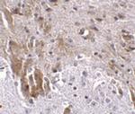 LRFN1 Polyclonal Antibody