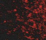 LRFN4 Antibody in Immunohistochemistry (IHC)