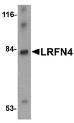 LRFN4 Antibody in Western Blot (WB)