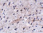 LRFN5 Antibody in Immunohistochemistry (IHC)