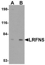 LRFN5 Antibody in Western Blot (WB)
