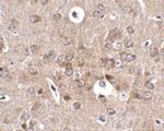 PCDH18 Antibody in Immunohistochemistry (IHC)
