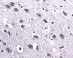 LRFN2 Polyclonal Antibody