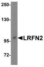 LRFN2 Antibody in Western Blot (WB)