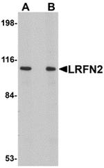 LRFN2 Antibody in Western Blot (WB)