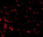 LRFN3 Antibody in Immunohistochemistry (IHC)