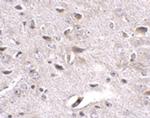 LRFN3 Polyclonal Antibody