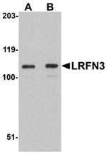 LRFN3 Antibody in Western Blot (WB)
