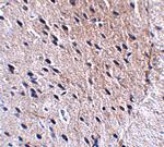 Bora Antibody in Immunohistochemistry (IHC)