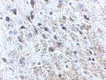 Amyloid Precursor Protein Polyclonal Antibody