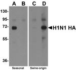 Influenza A H1N1 HA Polyclonal Antibody