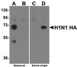 Swine Influenza H1N1 HA Polyclonal Antibody
