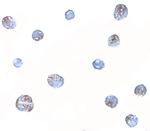 NDP Polyclonal Antibody