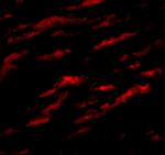 MATN1 Polyclonal Antibody